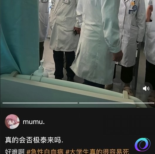 OO加速器